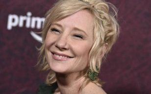 Actress Anne Heche in coma with severe burns after fiery car wreck